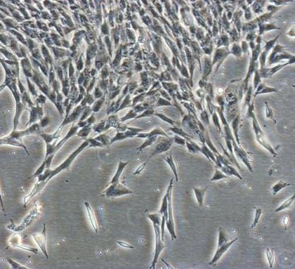 Marrow adipocytes inhibit the differentiation of mesenchymal stem cells into osteoblasts via suppressing BMP-signaling