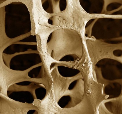 Serum 25-hydroxyvitamin D cutoffs for functional bone measures in postmenopausal osteoporosis