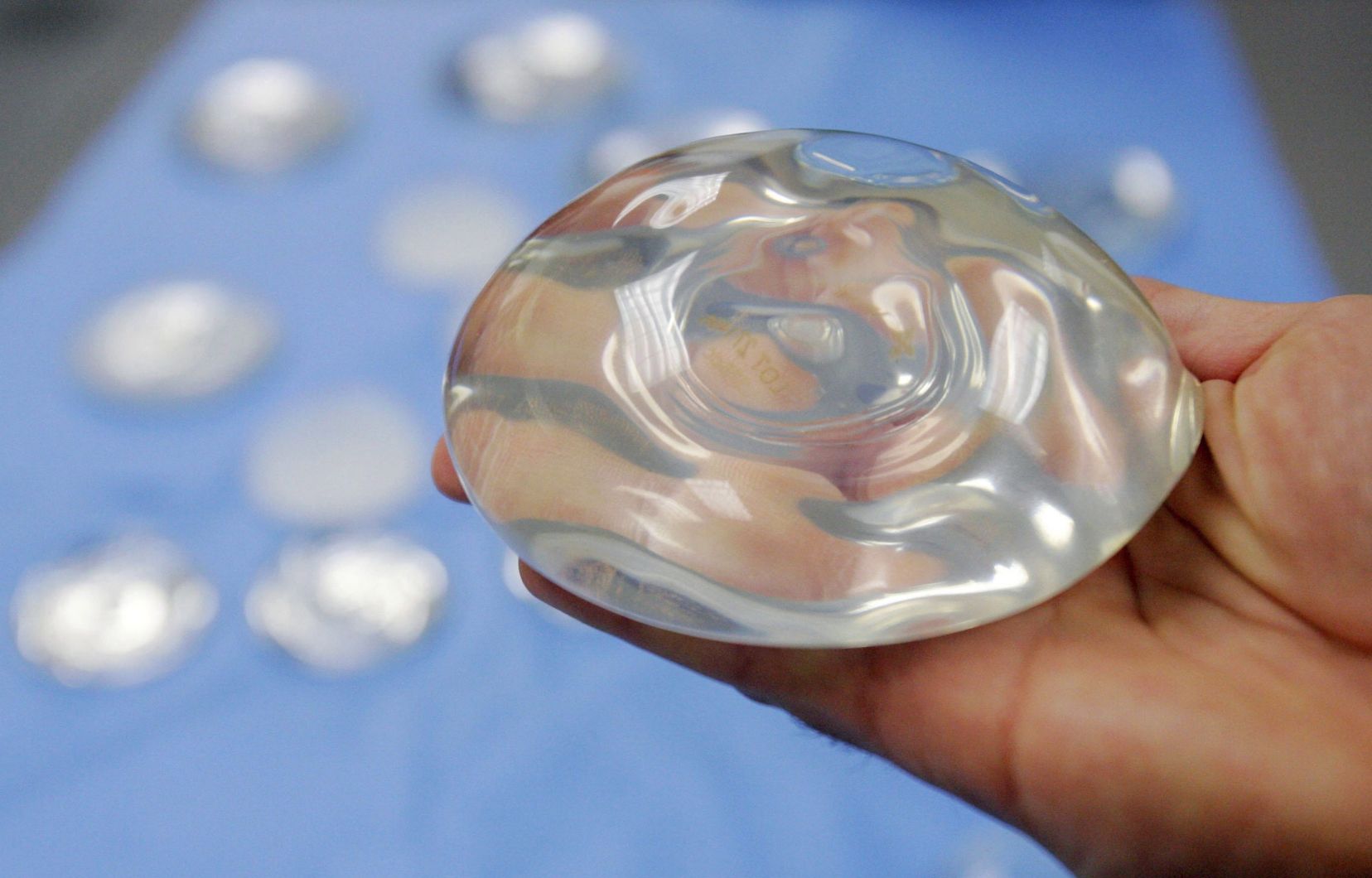 Comunicado de la Sociedad Chilena de Mastología respecto a Implantes mamarios